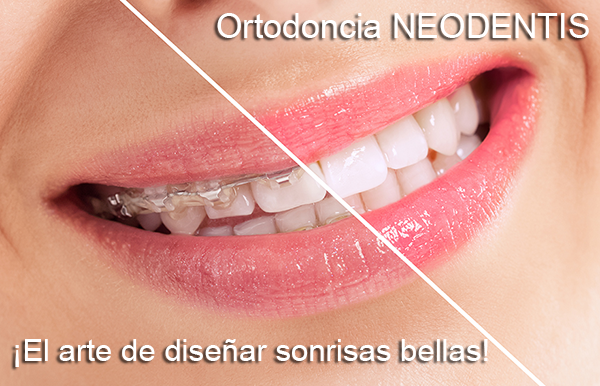 ortodoncia en Perú Lima